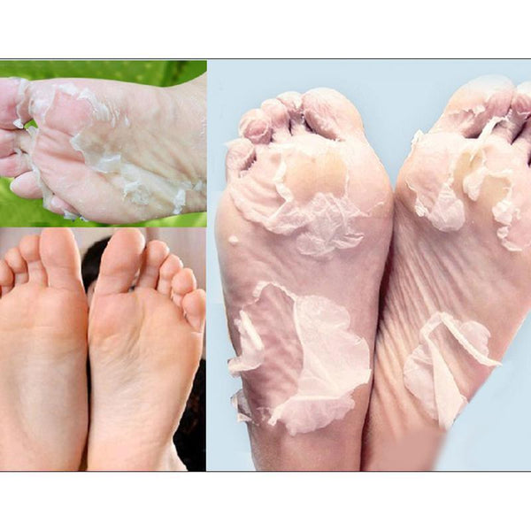 Baby Foot Exfoliant Foot Peel